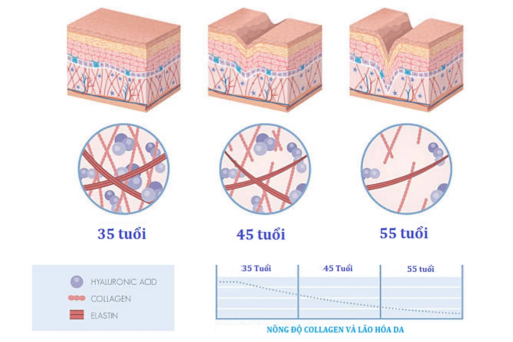 collagen-va-nhung-luu-y-khi-su-dung Nồng độ collagen trong cơ thể sẽ mất đi dần theo thời gian, chính vì vậy mới có ựu lão hóa. Lão hóa nhanh hay chậm phụ thuộc vào lượng tiêu hao collagen trong cơ thể của mỗi người. tuy vậy cũng không nên lạm dụng dung nạp quá nhiều collagen. Hãy đọc bài viết collagen và những lưu ý khi sử dụng. đọc qua hướng dẫn sử dụng "những lưu ý khi sử dụng collagen"
